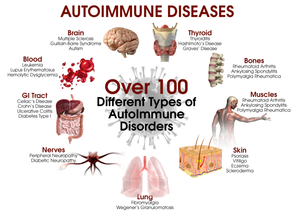 autoimmune